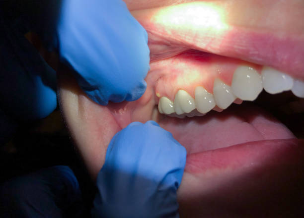 Best Pediatric Emergency Dentist in Brownsville, OR